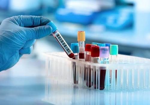 Blood Test
